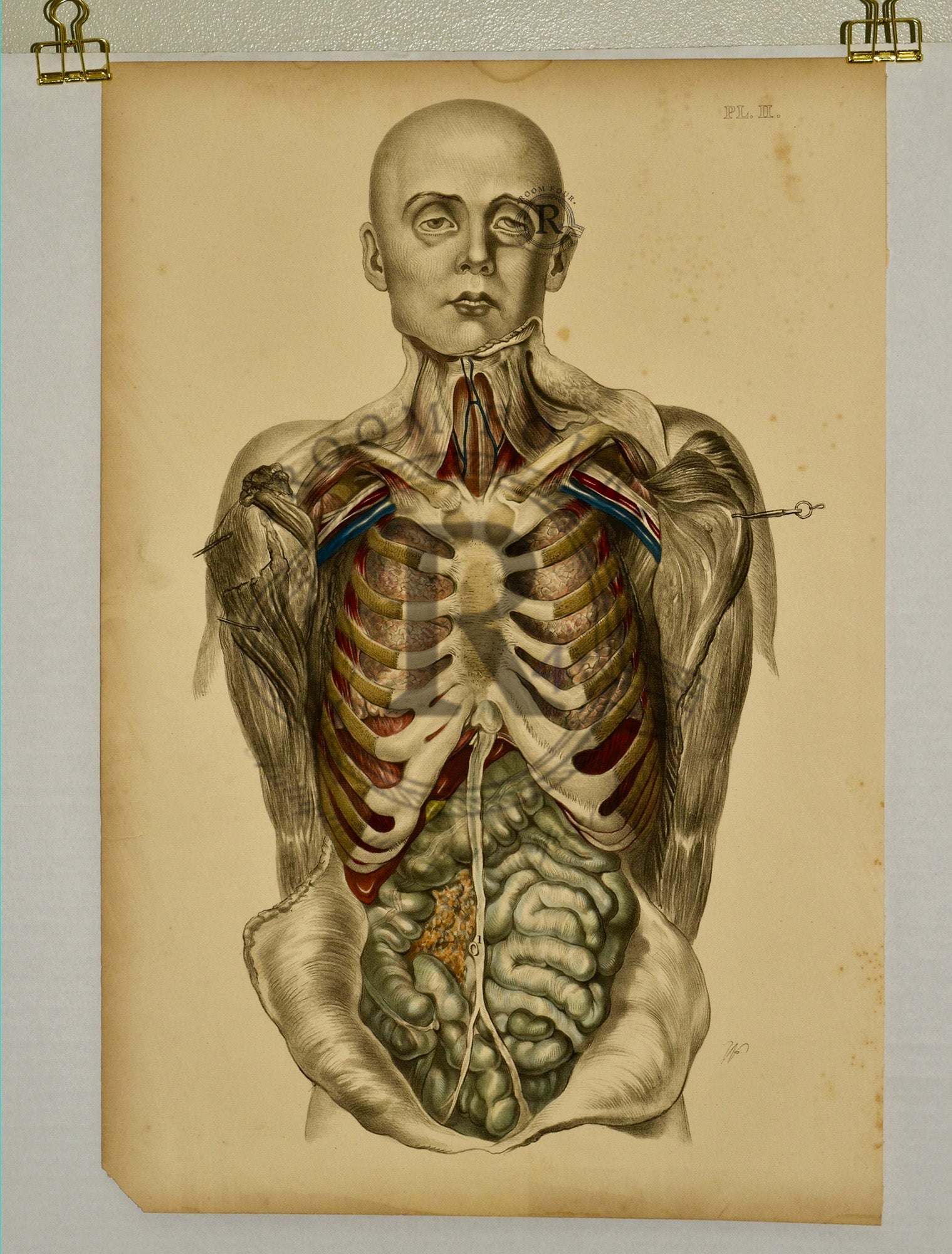 Anatomical Folio Art Surgical Post Mortem 19th Century - Room Four