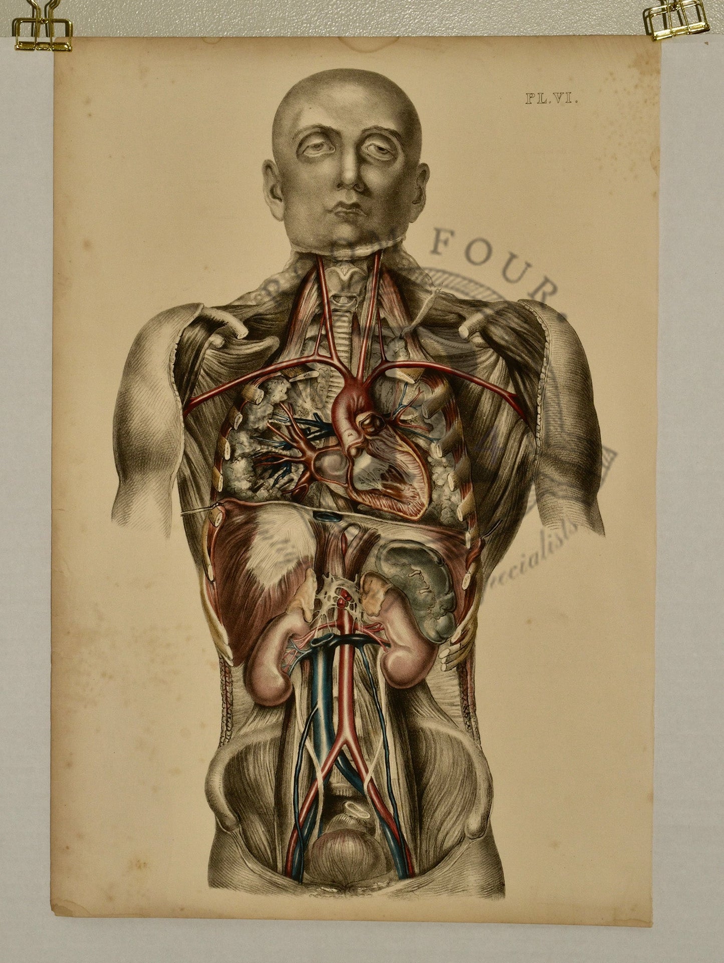 Anatomical Folio Art Surgical Post Mortem 19th Century - Room Four