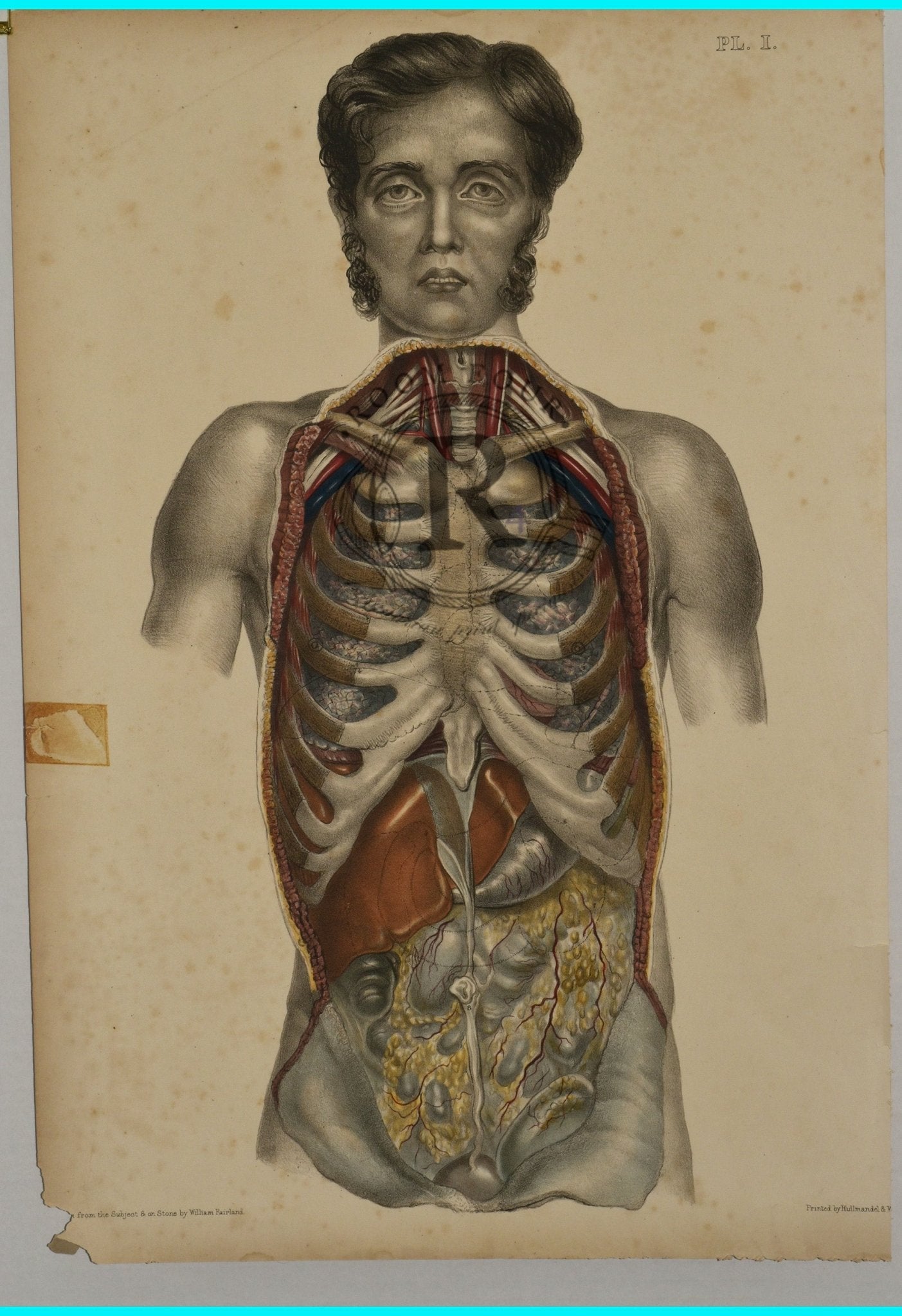 Anatomical Folio Art Surgical Post Mortem 19th Century - Room Four