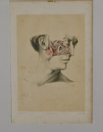 Anatomical Medical Dissection Drawing 19th Century - Room Four