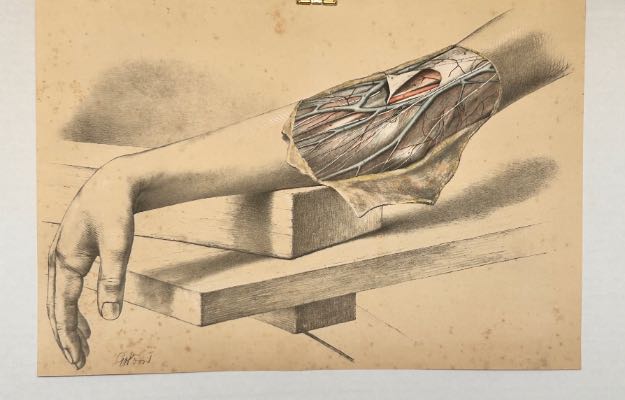 Antique Anatomical Dissection Drawing Vascular Human Arm – Room Four