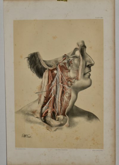 Anatomical Medical Dissection Drawing 19th Century - Room Four
