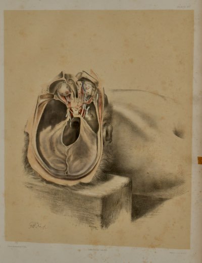 Anatomical Medical Dissection Drawing 19th Century - Room Four