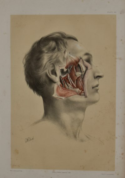 Anatomical Medical Dissection Drawing 19th Century - Room Four