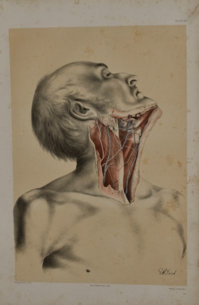 Anatomical Medical Dissection Drawing 19th Century - Room Four