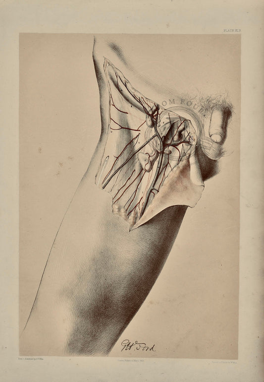 Anatomical Medical Dissection Drawing, Upper Leg plate XLII - Room Four