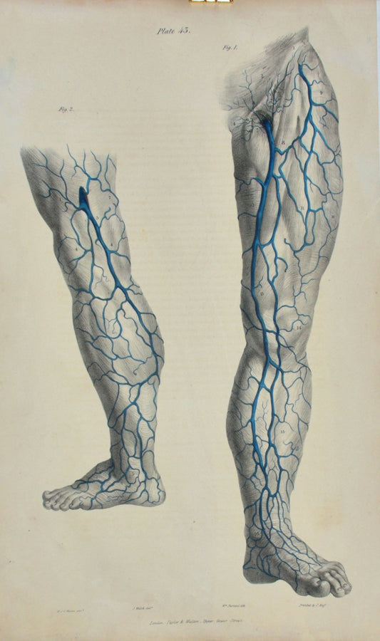 Anatomical Original Artwork - Vascular Lower Extremity 43 - Room Four