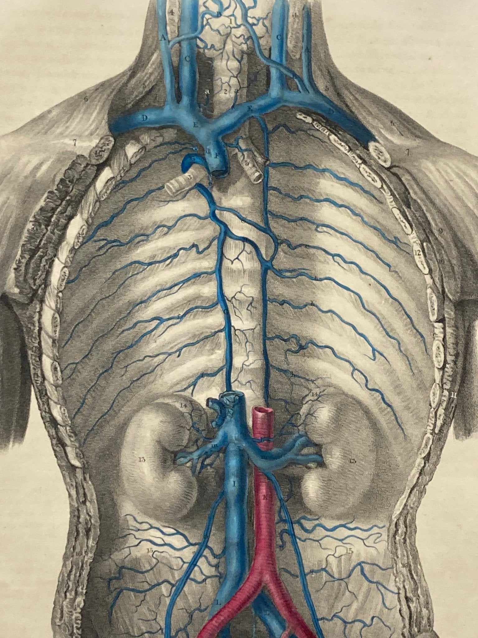 Anatomical Original Artwork - Vascular Vena Cava 42 - Room Four