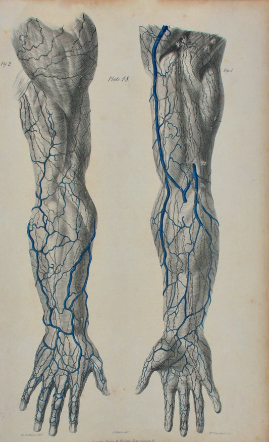 Anatomical Original Wall Art - Vascular Arms & Hands 48 - Room Four
