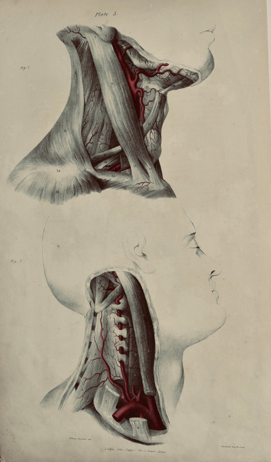 Anatomical Original Wall Art - Vascular Head & Neck 5 - Room Four