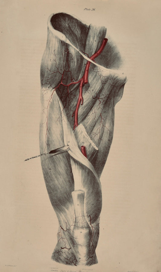Anatomical Original Wall Art - Vascular Leg 26 - Room Four