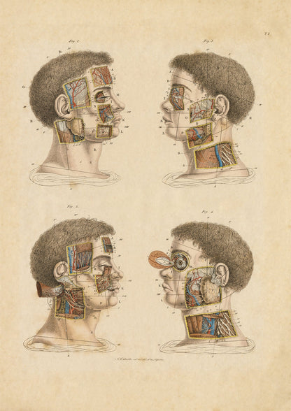 Anatomical Wall Art Prints of Human Anatomy Post Mortem - Head - Room Four