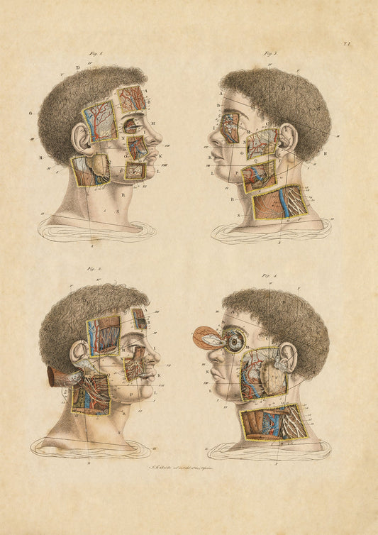 Anatomical Wall Art Prints of Human Anatomy Post Mortem - Head - Room Four