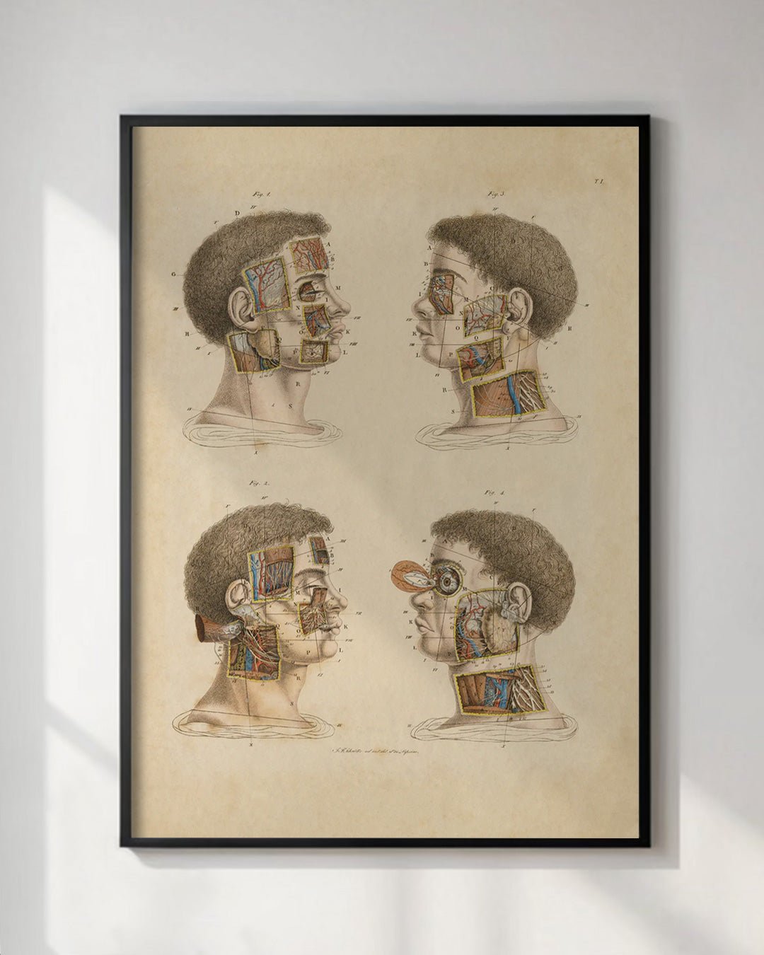 Anatomical Wall Art Prints of Human Anatomy Post Mortem - Head - Room Four