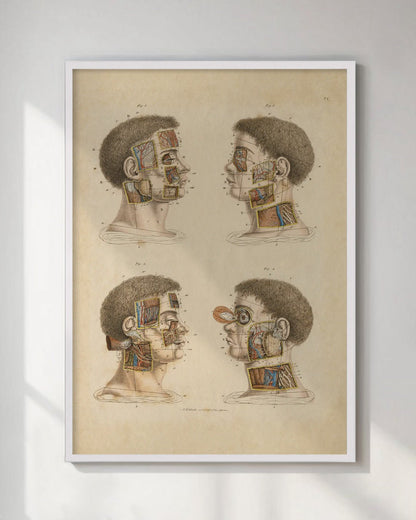 Anatomical Wall Art Prints of Human Anatomy Post Mortem - Head - Room Four