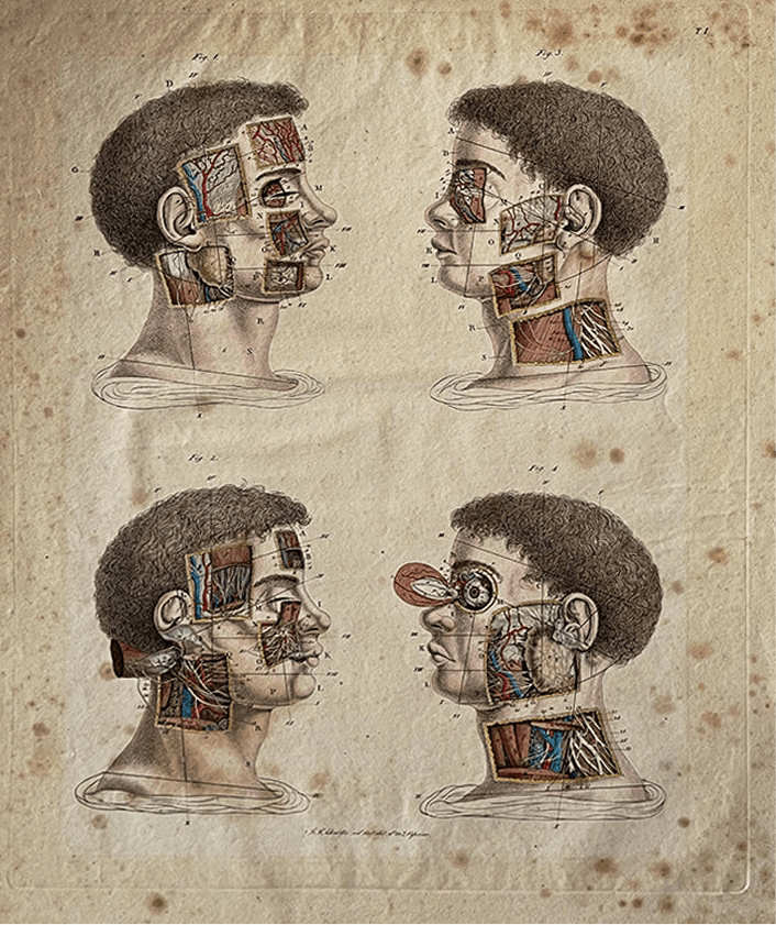 Early Anatomy Coloured Engravings Wall Art Post Mortem - Head - Room Four