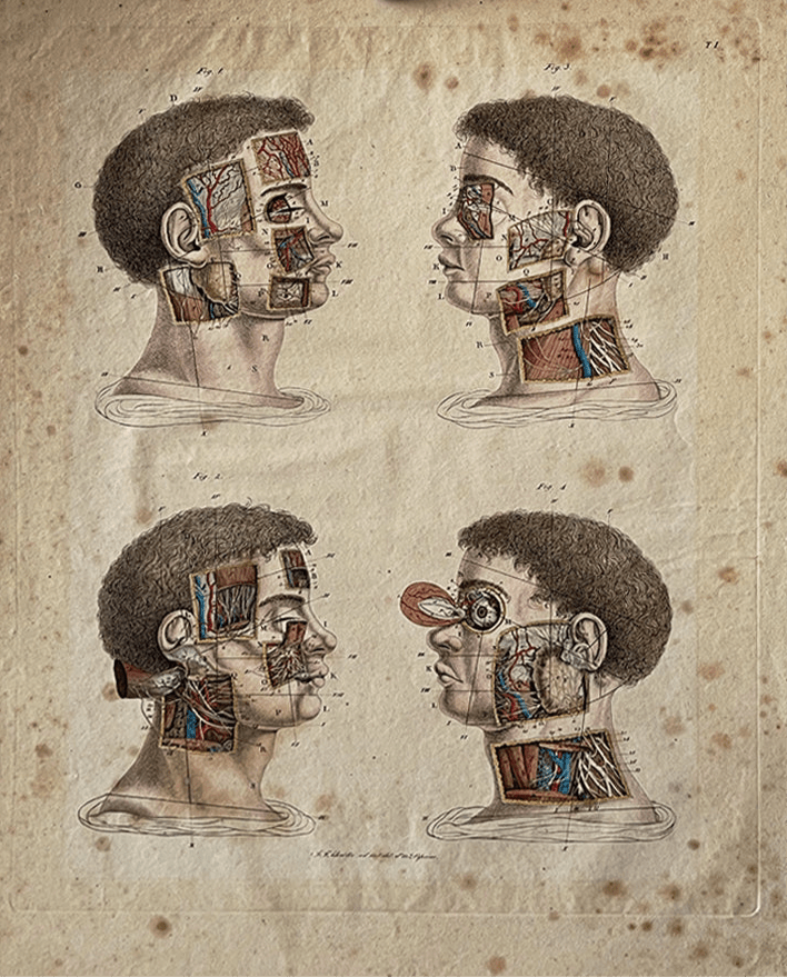 Early Anatomy Coloured Engravings Wall Art Post Mortem - Head - Room Four