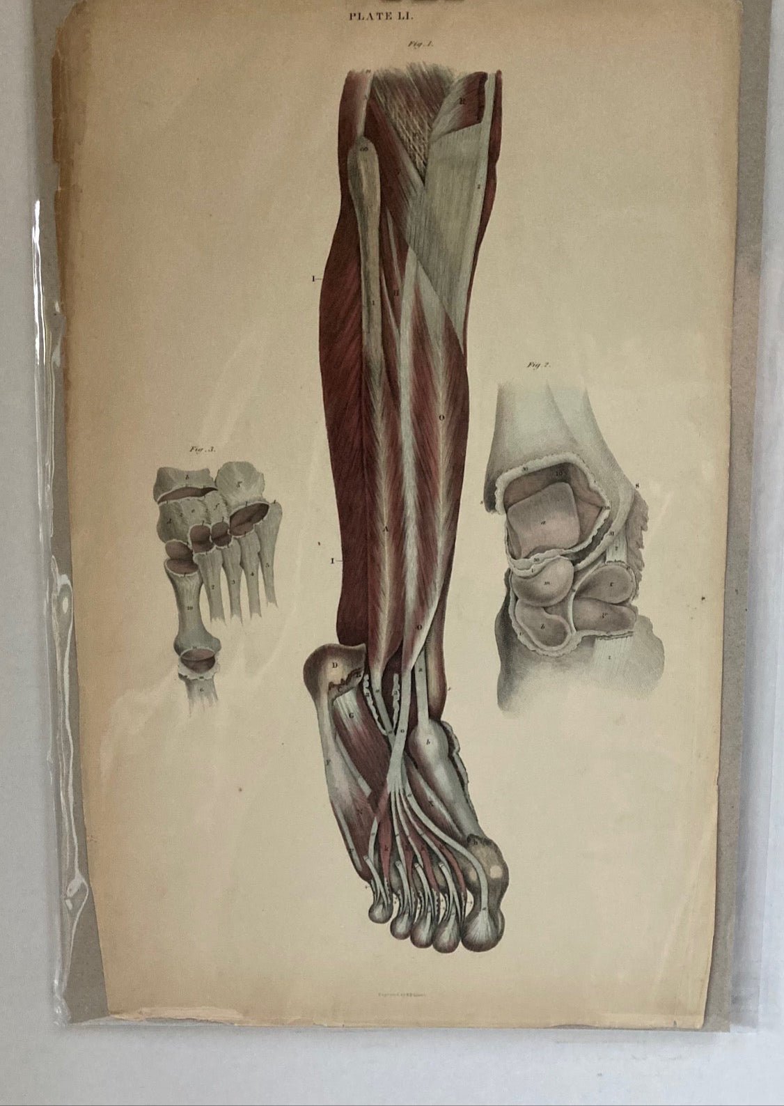 Early Anatomy - Plate LI - ORIGINAL - Room Four