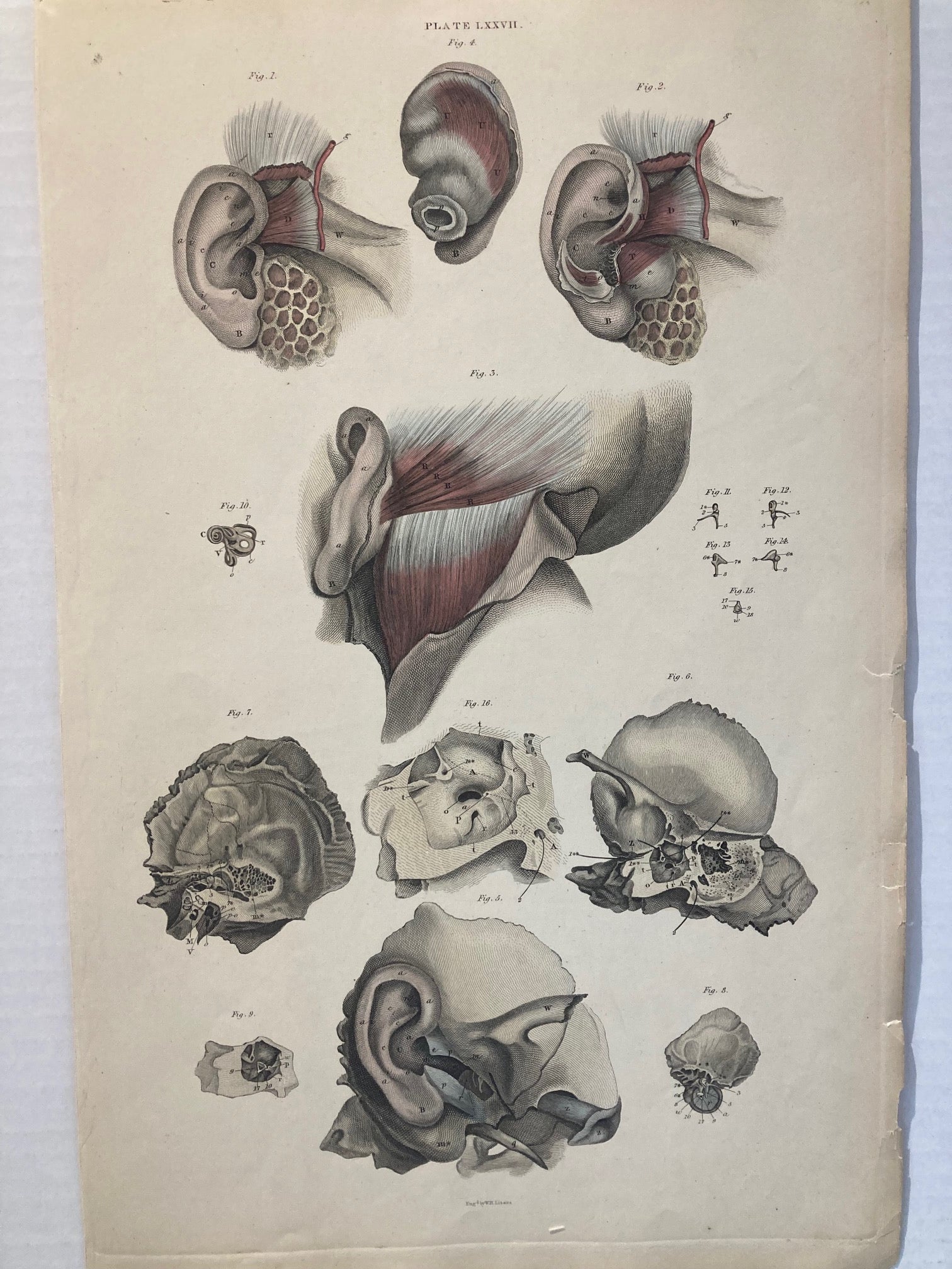 Early Anatomy - Plate LXXVII - ORIGINAL - Room Four