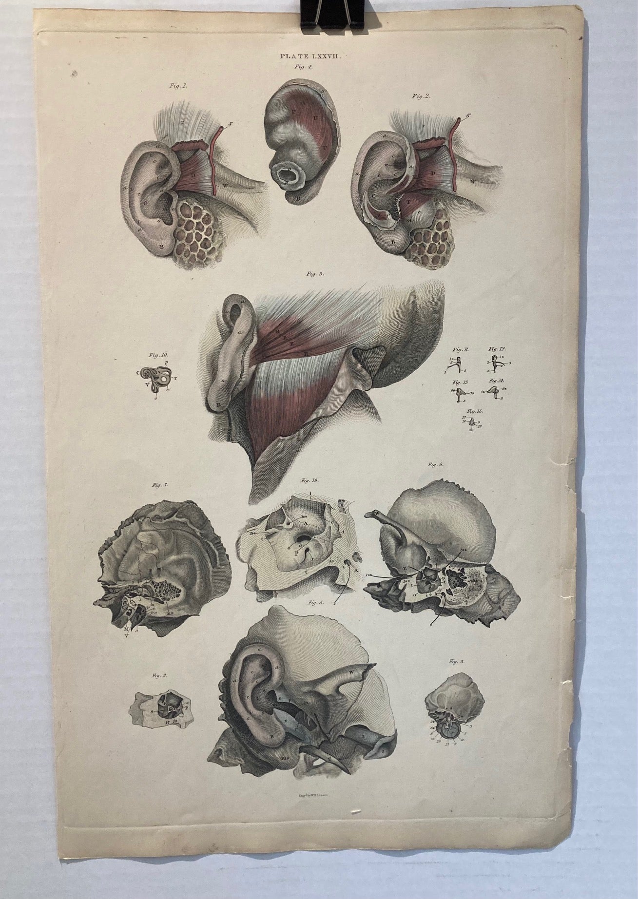 Early Anatomy - Plate LXXVII - ORIGINAL - Room Four