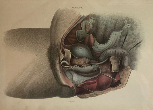 Early Anatomy - Plate XCIII - ORIGINAL - Room Four