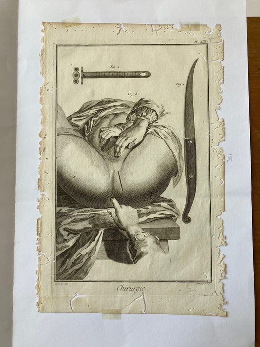 Early Surgical Engraving - French - Room Four