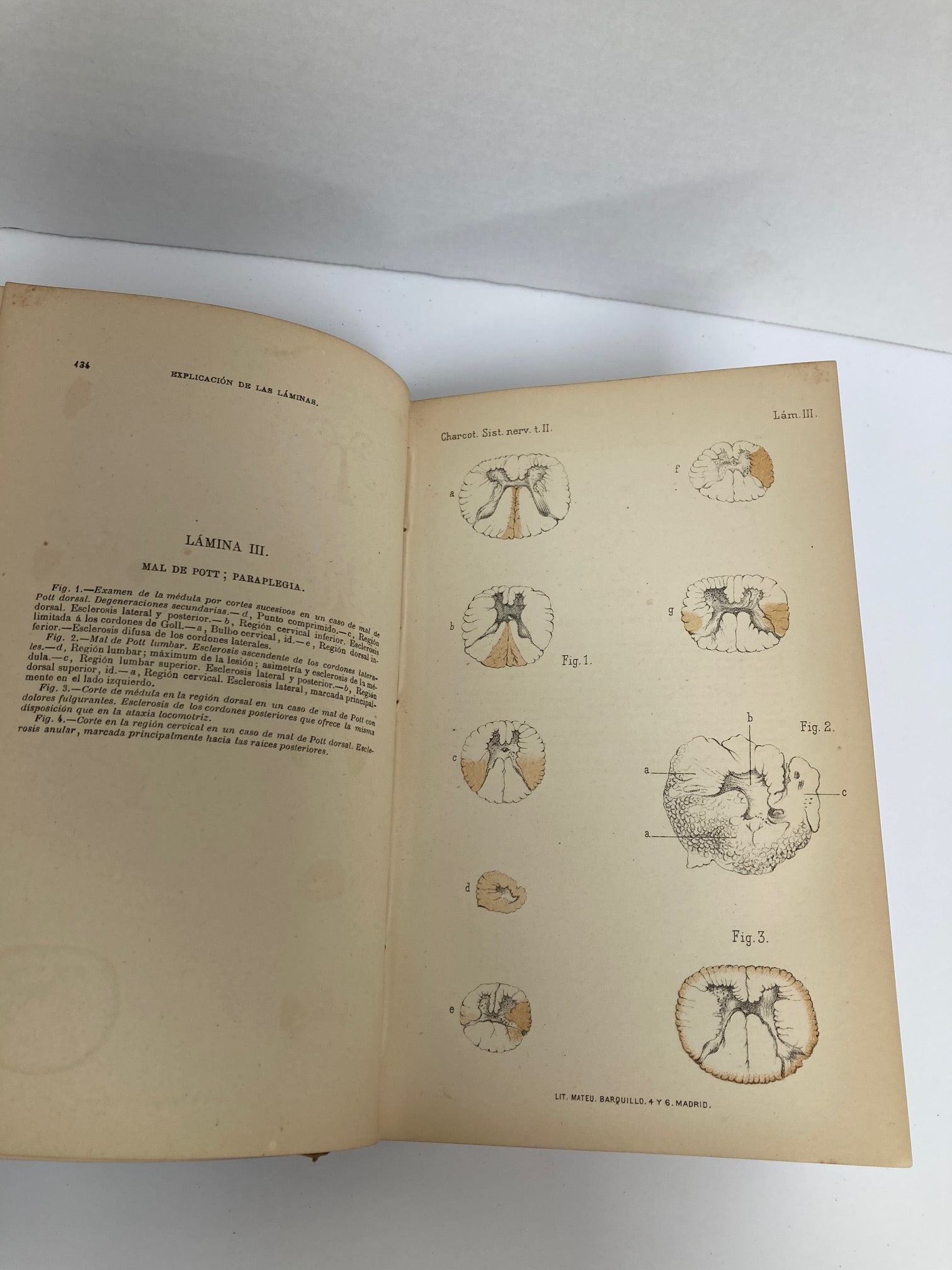 Enfermedades del Sistema Nervioso (2 Volumes) - Room Four