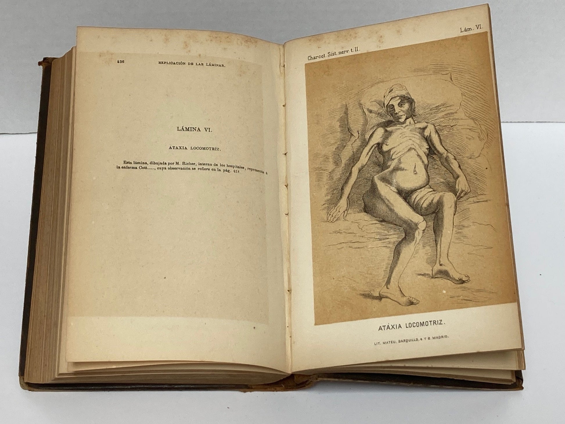 Enfermedades del Sistema Nervioso (2 Volumes) - Room Four