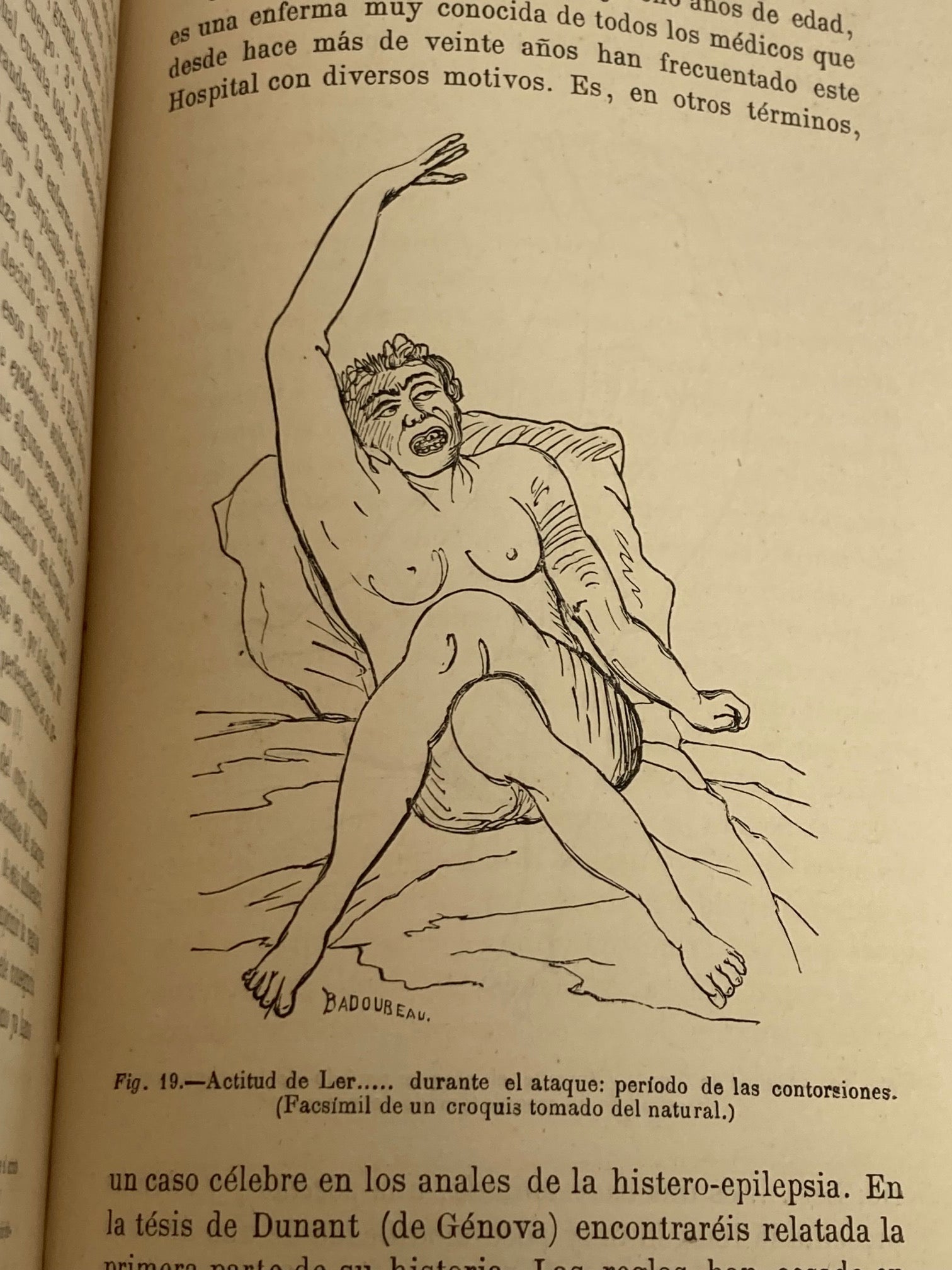Enfermedades del Sistema Nervioso (2 Volumes) - Room Four
