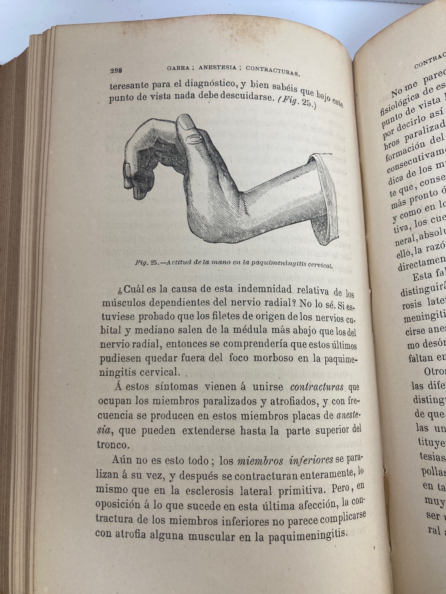 Enfermedades del Sistema Nervioso (2 Volumes) - Room Four