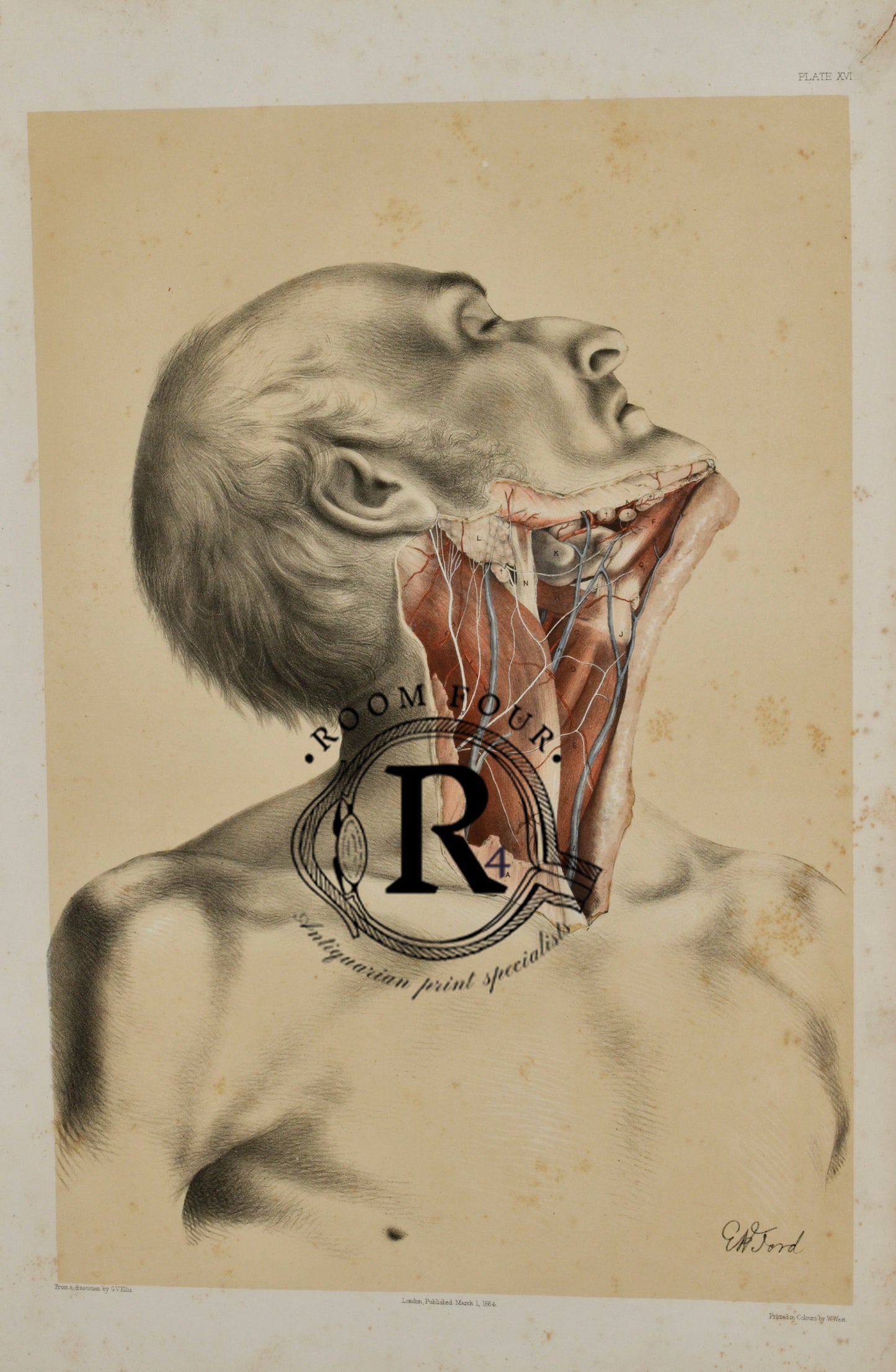 Anatomical Medical Dissection Drawing 19th Century