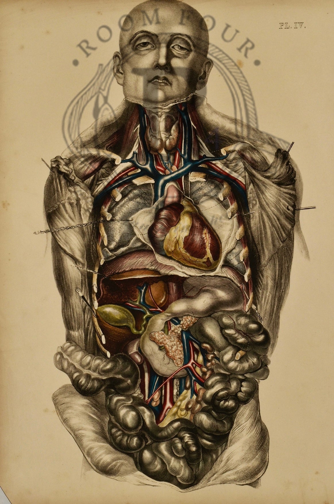 Human Anatomy Lithographic Print 19th Century - IV - Room Four