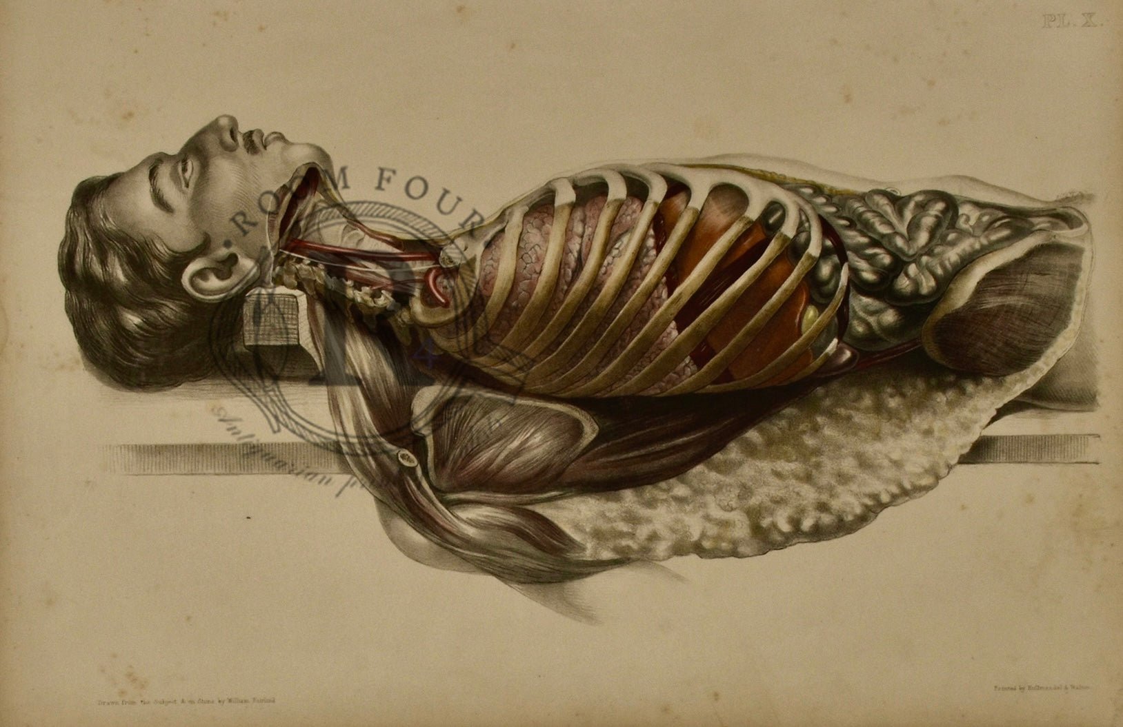 Human Anatomy Lithographic Print 19th Century - Plate X - Room Four