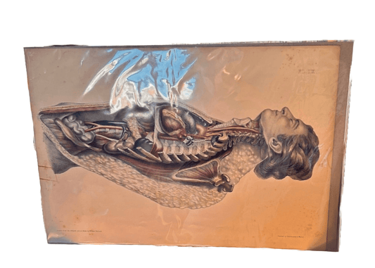 Human Anatomy Lithographic Print 19th Century - Plate XX - Room Four