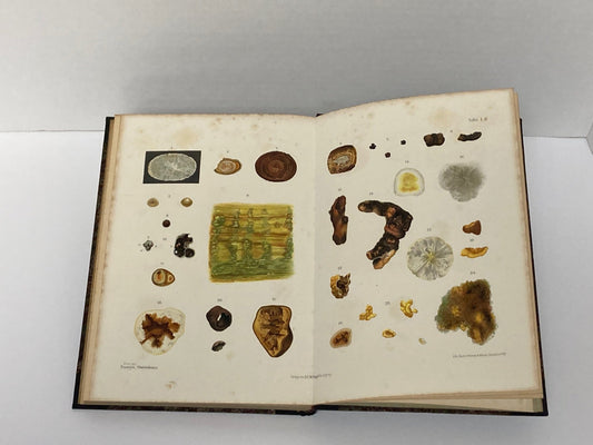 Klinik der Cholelithiasis, First Edition, 1892,(Gall Stones) - Room Four