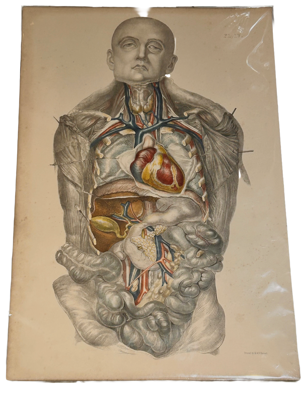 Frances Sibson Antique Anatomical Print – Plate IV, 19th Century Dissection Illustration