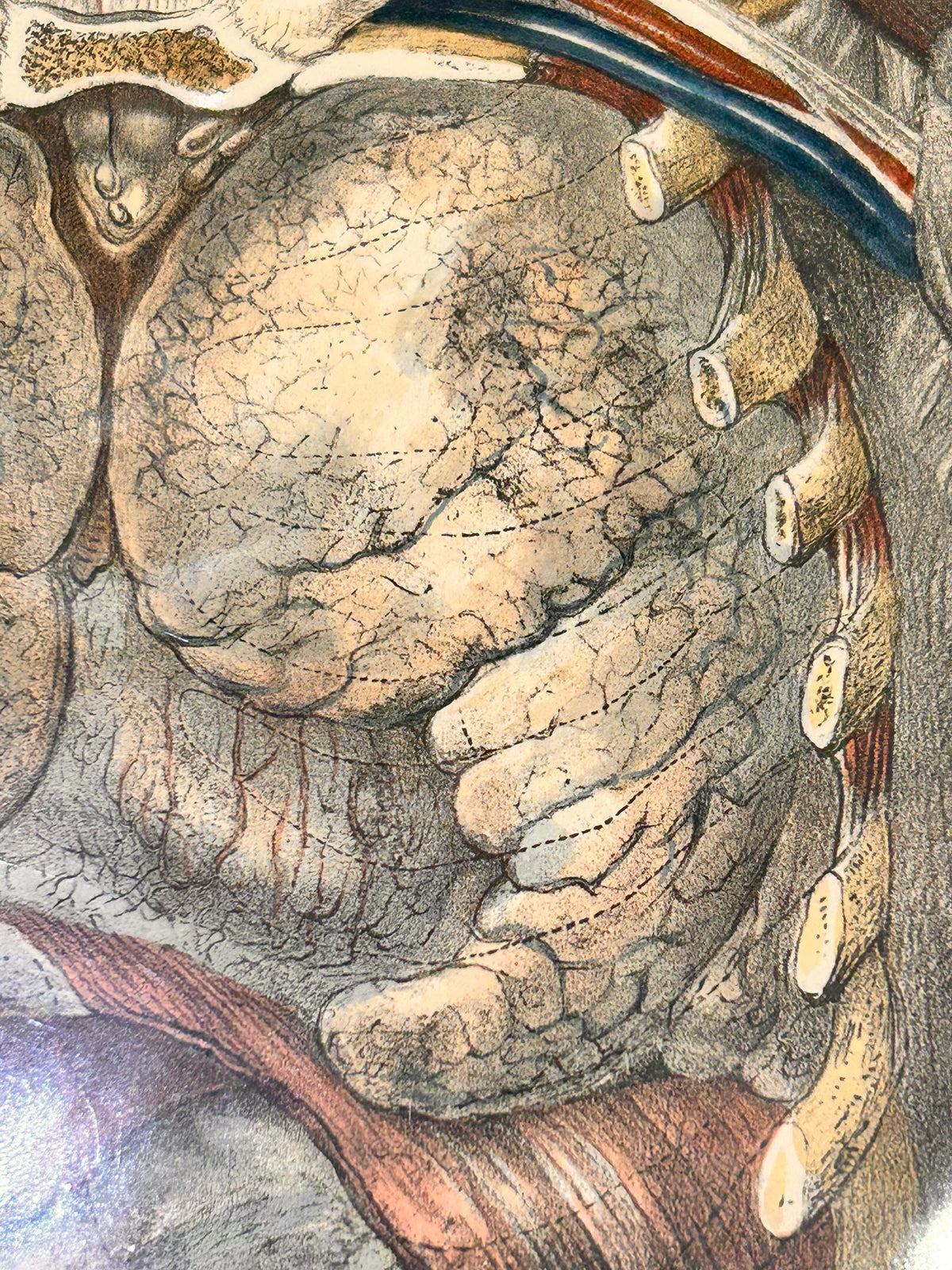 Frances Sibson Antique Anatomical Print – Plate III, 19th Century Dissection Illustration