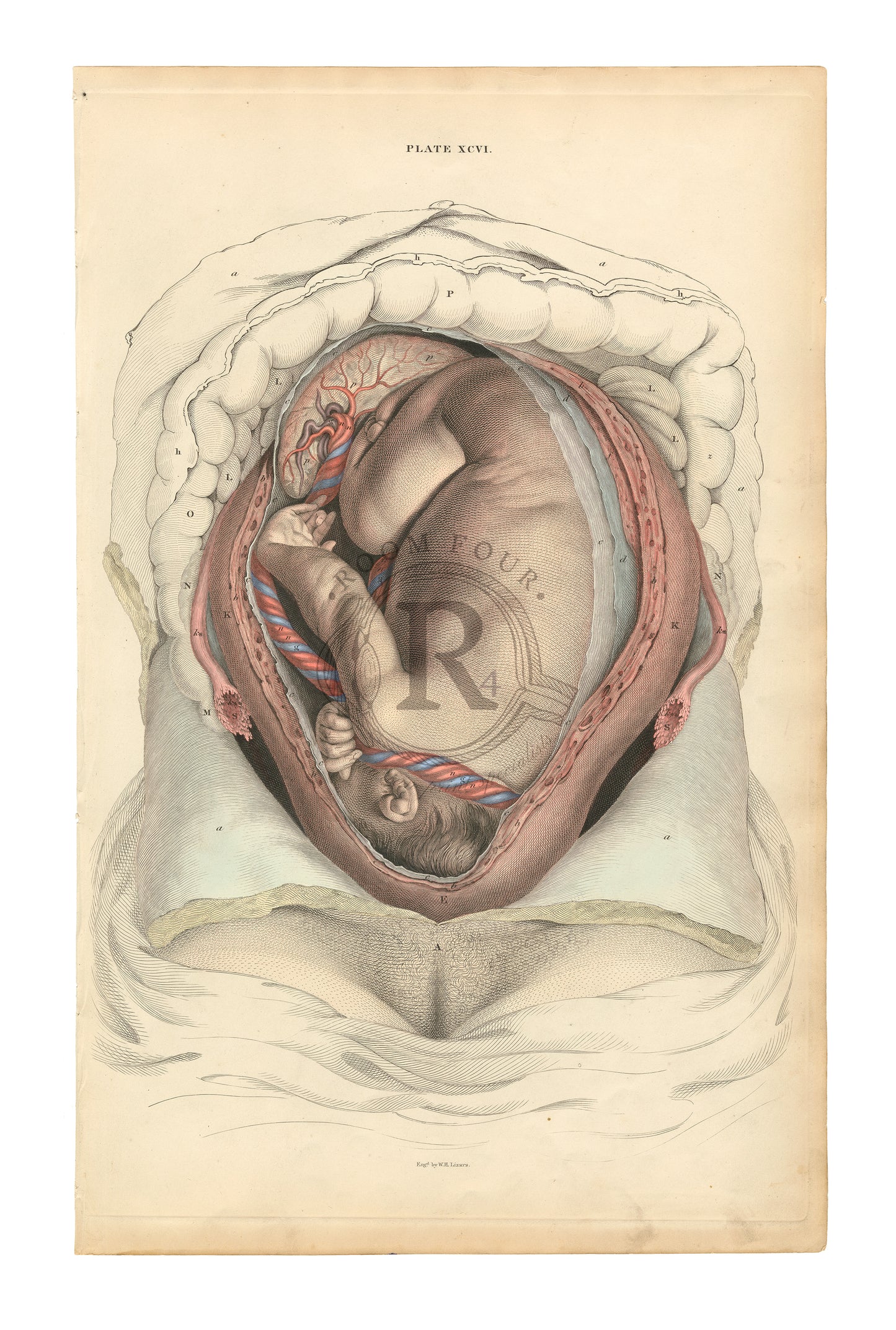  Lizars  Anatomical Giclée Print – Plate XCVI Fetus Dissection Full Term Reproduction for the original 19th century drawing. 