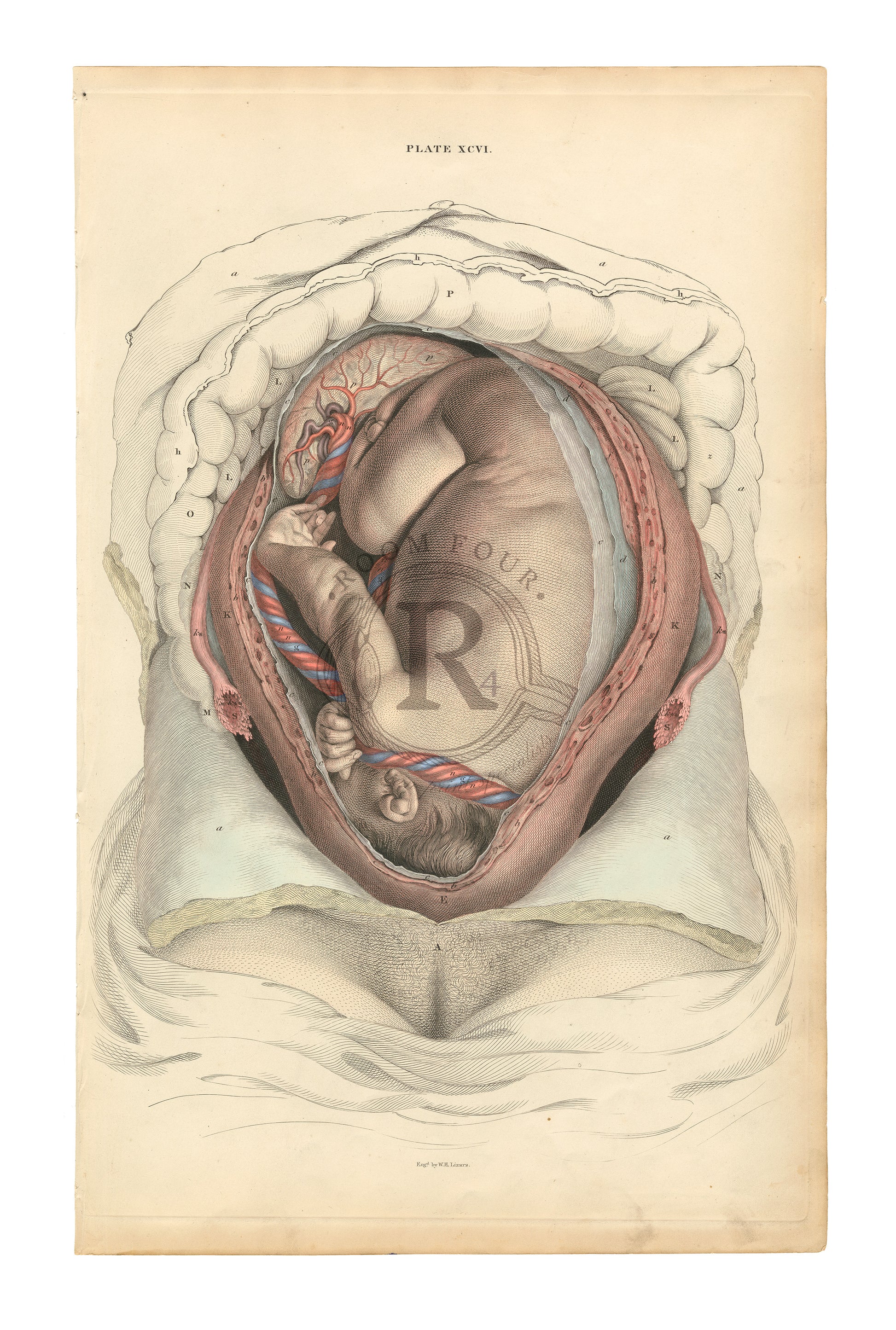  Lizars  Anatomical Giclée Print – Plate XCVI Fetus Dissection Full Term Reproduction for the original 19th century drawing. 