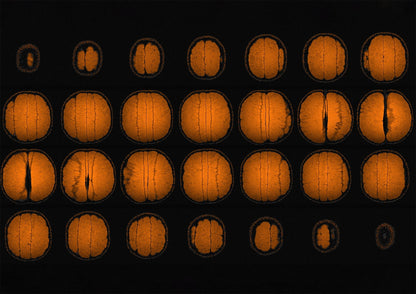 Mandarin Orange Fruit MRI Scan Kitchen Wall Art Print - Room Four
