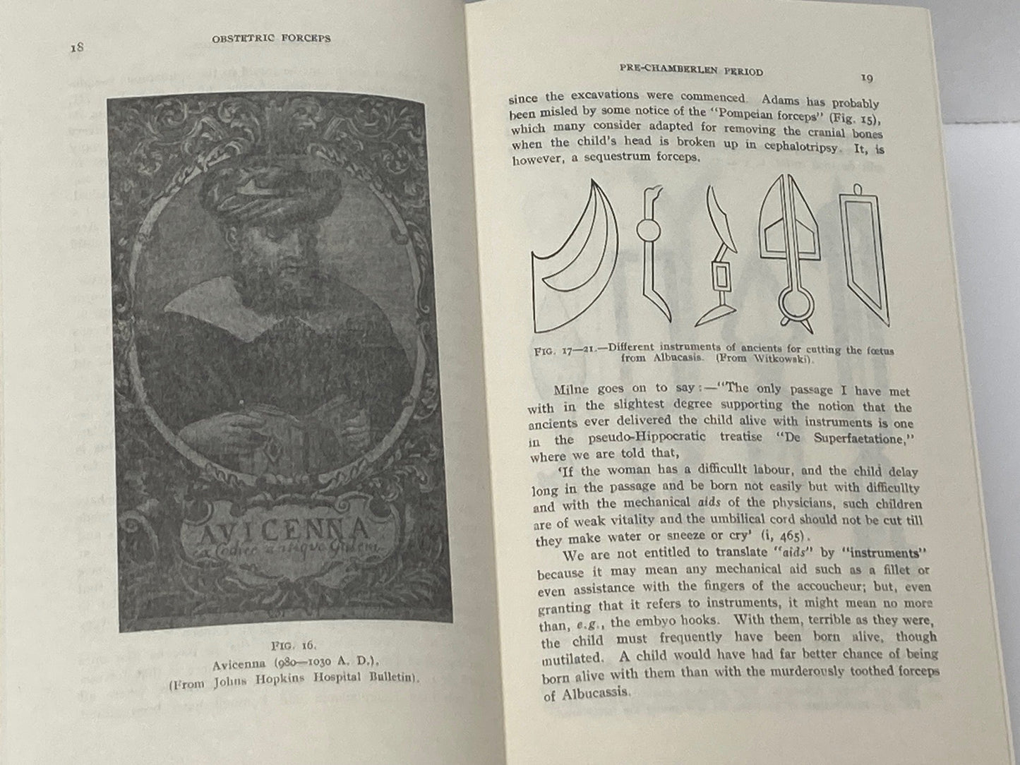 Obstetric Forceps Its History and Evolution - Room Four