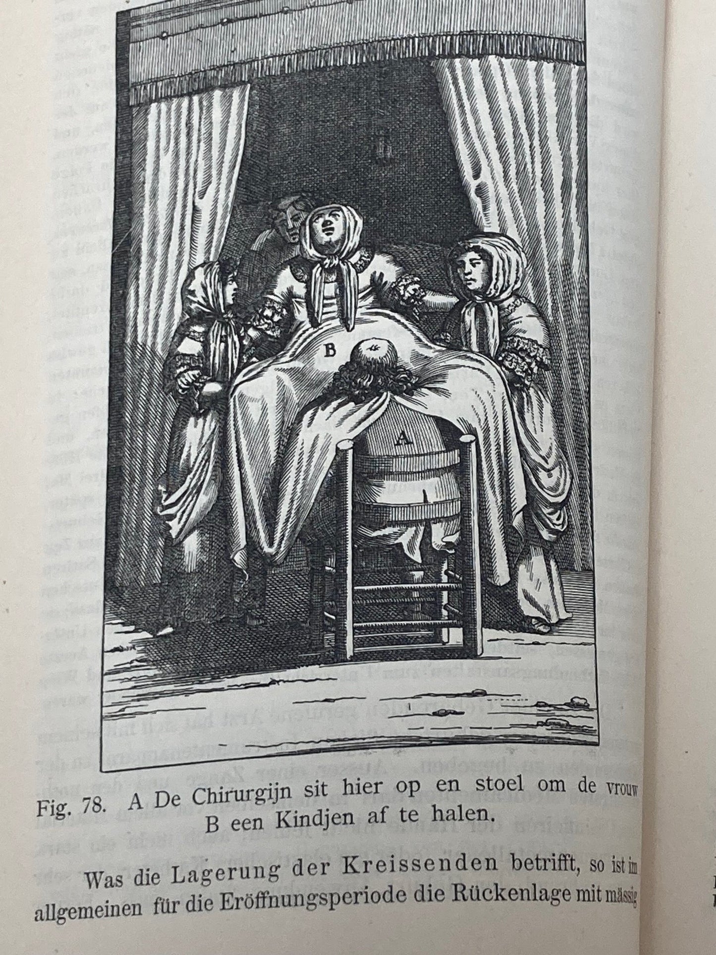 (Obstetrics) Lehrbuch der Geburtshilfe - 1891 - Room Four