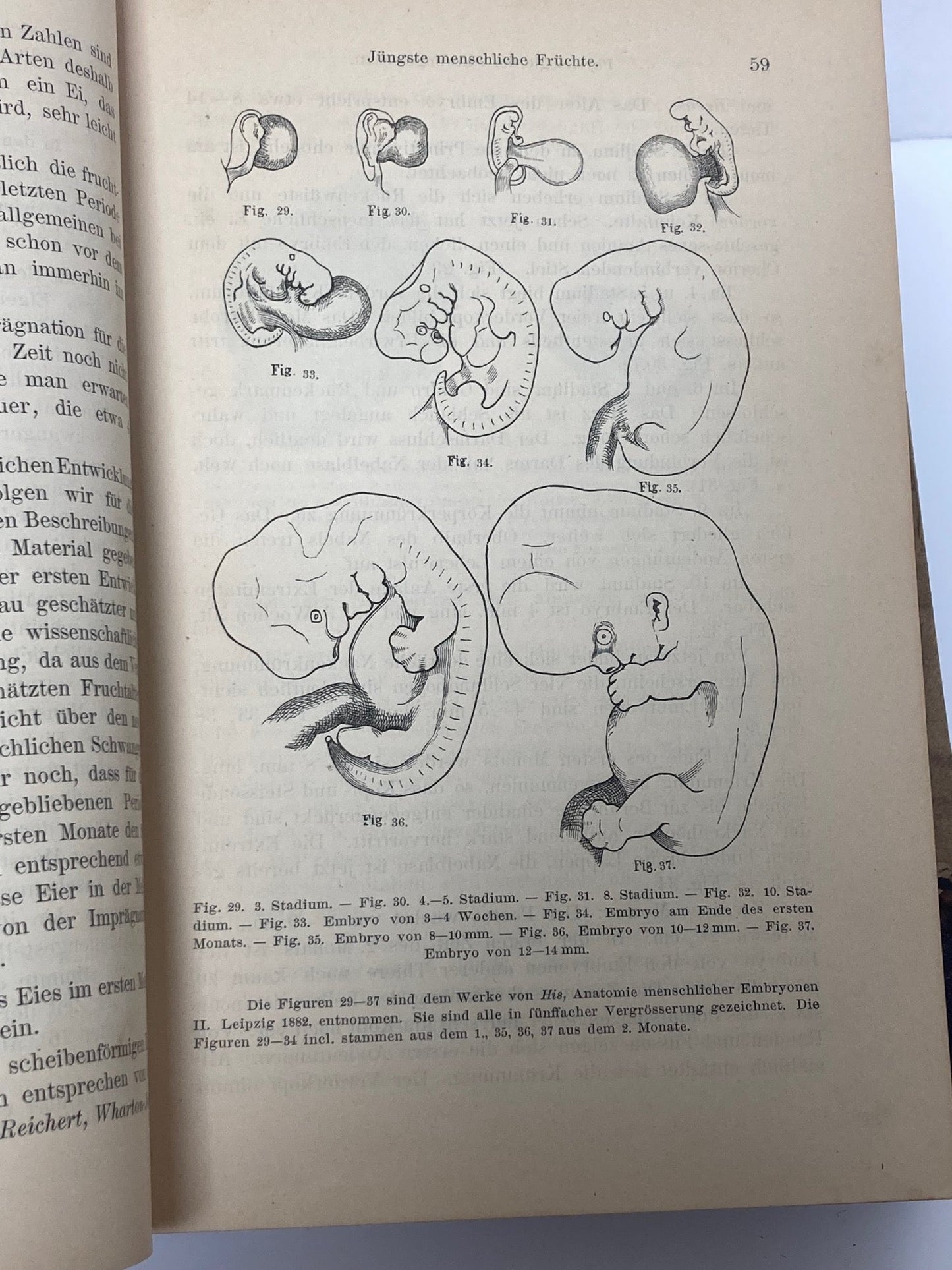 (Obstetrics) Lehrbuch der Geburtshilfe - 1891 - Room Four