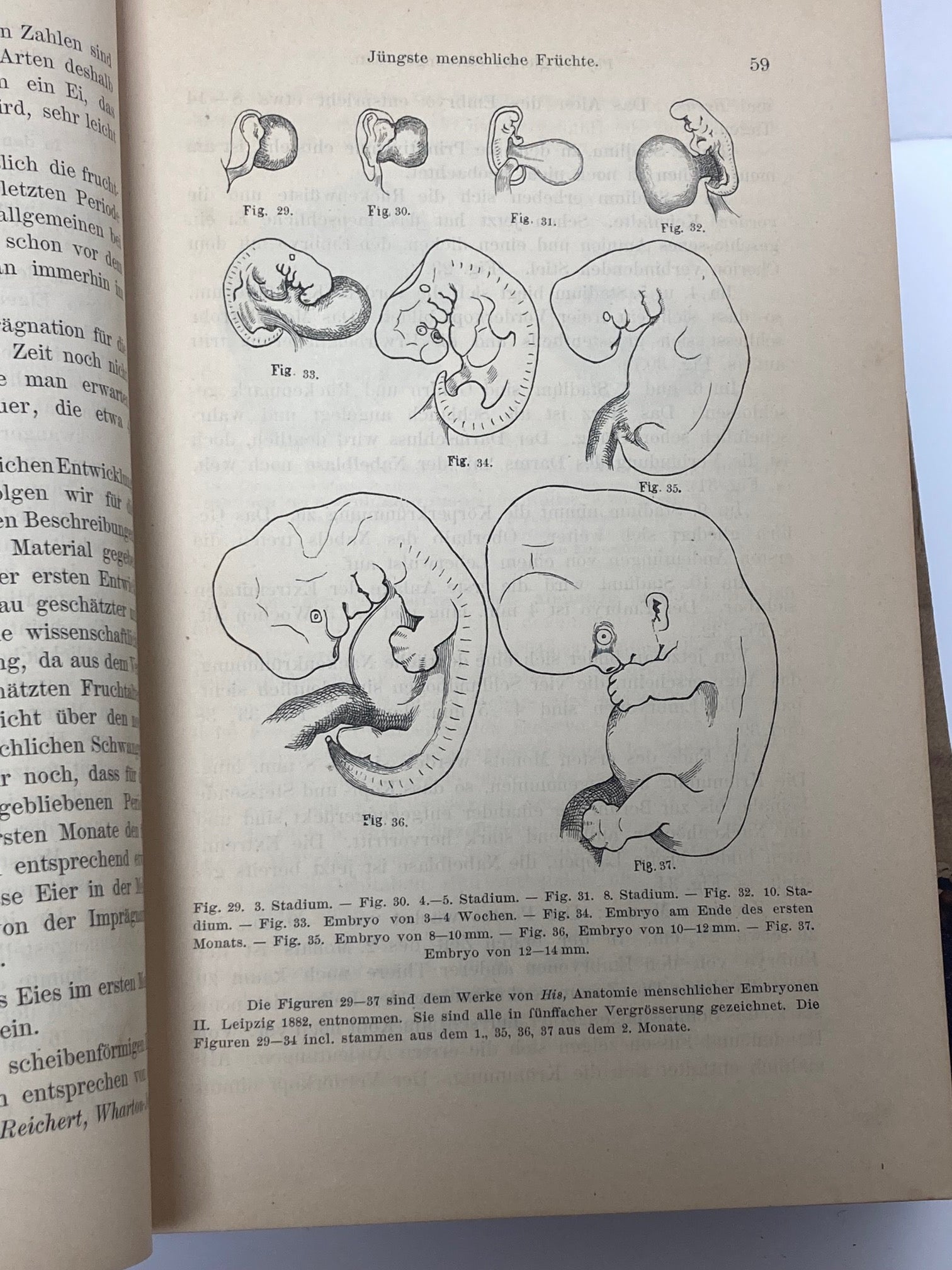 (Obstetrics) Lehrbuch der Geburtshilfe - 1891 - Room Four