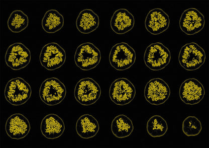 Passion Fruit MRI Scan Kitchen Wall Art Print - Room Four