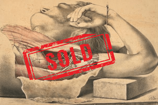 SOLD - Anatomical Medical Dissection Drawing 19th Century - Room Four