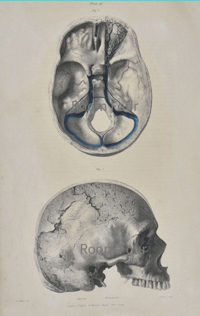 SOLD - Anatomical Original Artwork - Vascular Sinus & Ophthalmic 41 - Room Four