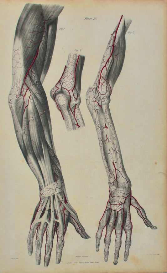 SOLD - Anatomical Original Wall Art - Vascular Arms & Hands 10 - Room Four