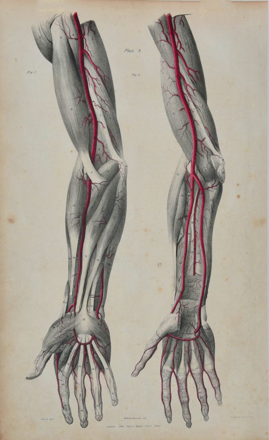 SOLD - Anatomical Original Wall Art - Vascular Arms & Hands 9 - Room Four