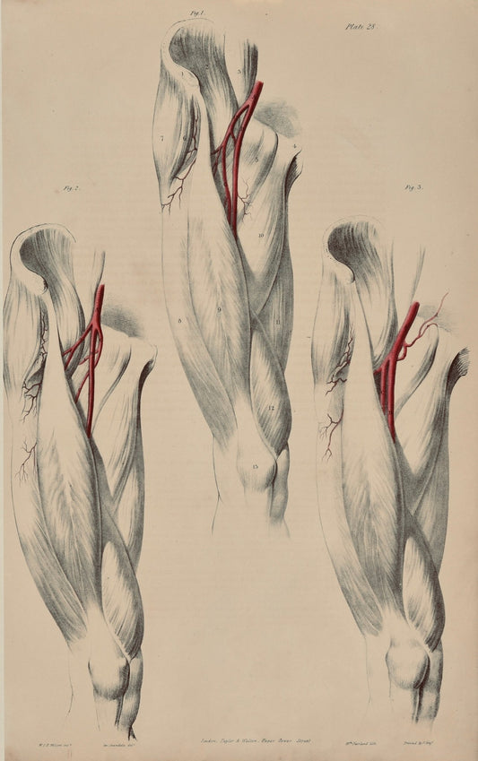 SOLD - Anatomical Original Wall Art - Vascular Leg 28 - Room Four